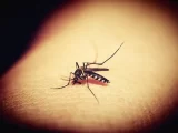 12 remèdes rapides pour soulager les piqûres de moustiques et les piqûres d'insectes qui démangent